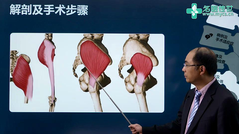 程飚:臀肌挛缩的关节镜微创治疗