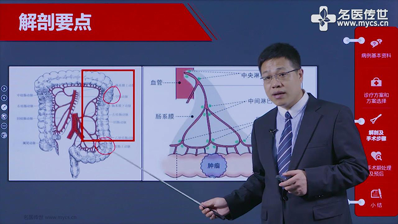 王俊江:腹腔镜下电钩辅助左半结肠癌根治术