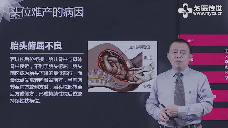 产科  广东省第二人民医院朱宁湖主任医师在视频中通过介绍胎头及骨盆