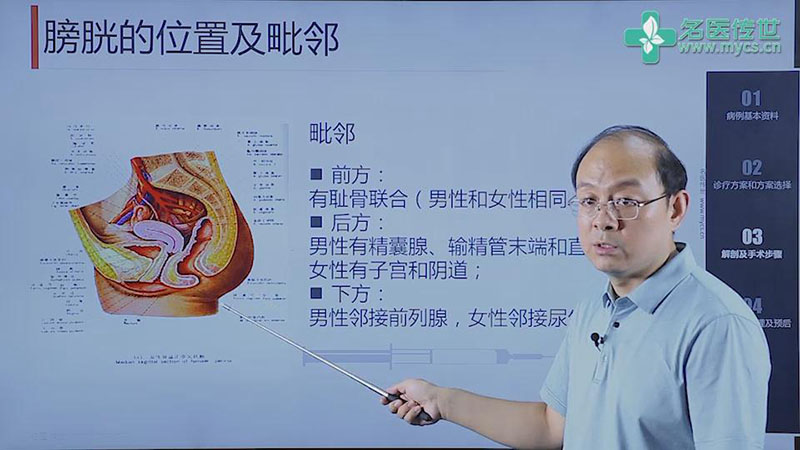 赵磊:腹腔镜膀胱根治性切除术 回肠膀胱术(brick膀胱)